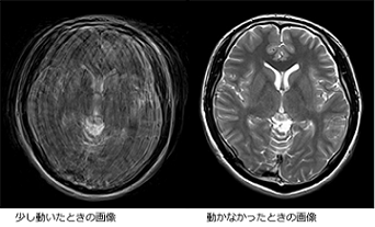 写真　検査で動いた時の画像例