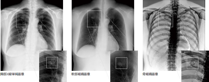 イメージ図　胸部Ｘ線撮影画像