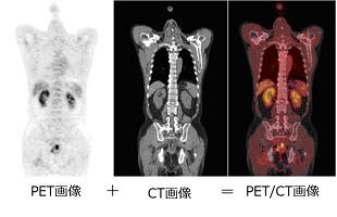 画像　PET CT