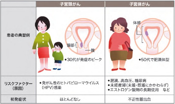 イメージ図　子宮頸がん・体がん患者の典型例