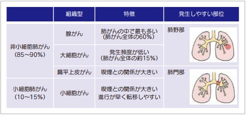 イメージ図 図4 肺がんの種類