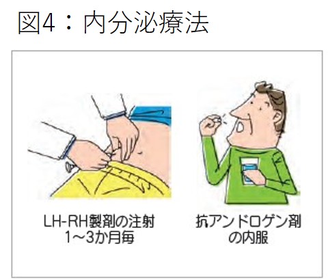 イメージ図　内分泌療法