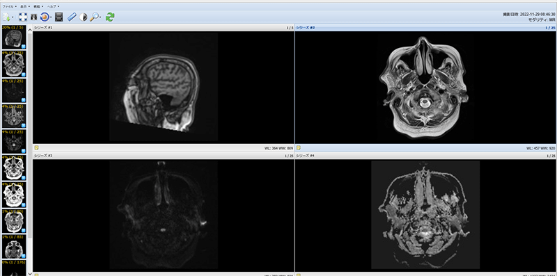 イメージ図　MRI