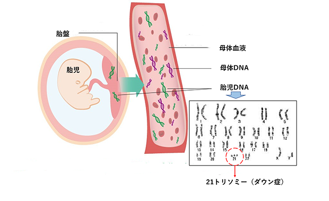 イメージ図　NIPT(新型出生前検査)