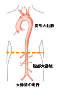 イメージ図　大動脈の走行