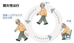 イメージ図　間欠性は行