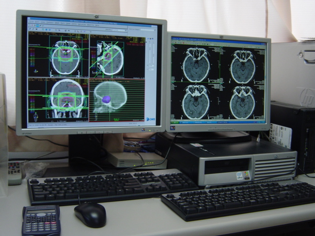 写真　治療計画シミュレータ1